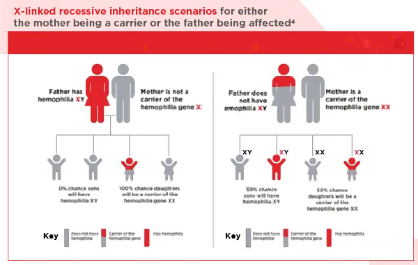 Infographic showing hemophilia as an X-linked recessive genetic disorder